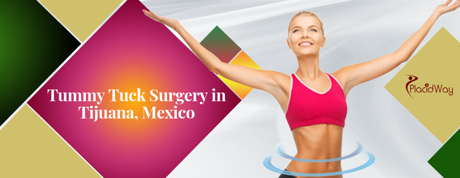Tummy Tuck Surgery in Tijuana, Mexico